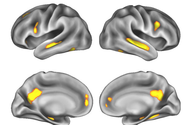 Pregnancy and the Brain Brain Changes 022818
